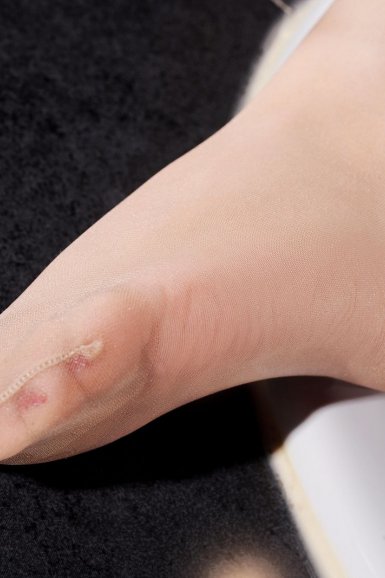 “开运体育(中国)官方网站”北京爆发麻疹疫情大厦并未封锁 五千人将接种疫苗(图1) 开运 SPORTS